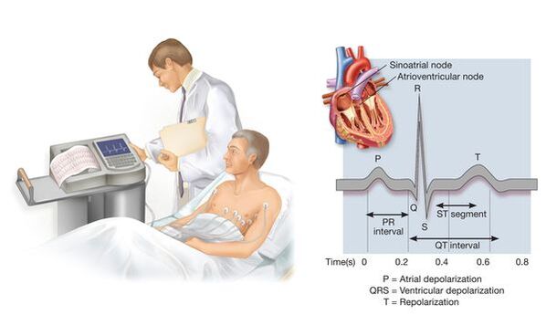 Electrocardiografie pentru depistarea bolilor cardiovasculare în hipertensiune arterială